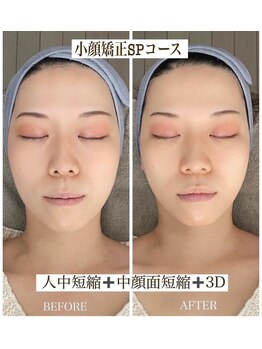 セリア(CELIA)/小顔ならお任せください