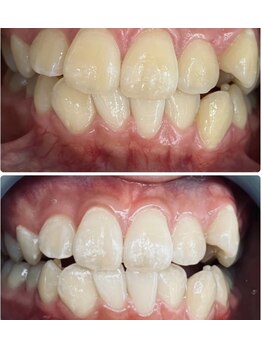 シャイニー 仙台駅東口(SHINY)/お客様の変化