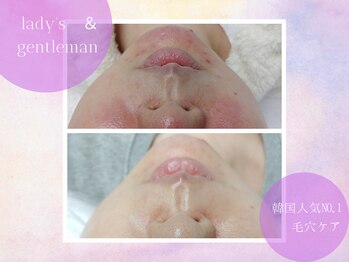 チャパン(Chapan)/韓国すっぴん美人＆毛穴ケア専門