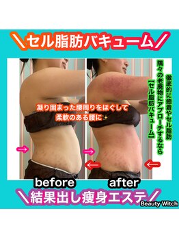 ビューティ ウィッチ(Beauty Witch)/