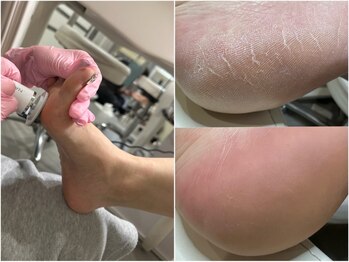 ネイル スパ ココプラス(Nail spa Cocoplus)の写真/パラジェルベース使用!オフ代+￥550でフィルイン一層残し◎つるふわ仕上げのプロのフットケアで足元に自信*