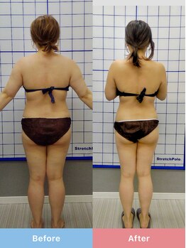 リスタート整体院 鹿児島(Restart整体院)/Restart痩身&ダイエット