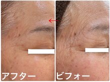 ナオフクオカ ヒーリングフォースエヌ(NaoFukuoka/healingforceN)/圧倒的変化！！