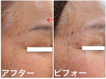 ナオフクオカ ヒーリングフォースエヌ(NaoFukuoka/healingforceN)/圧倒的変化！！