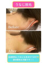 モット 神戸店(Motto)/全身脱毛