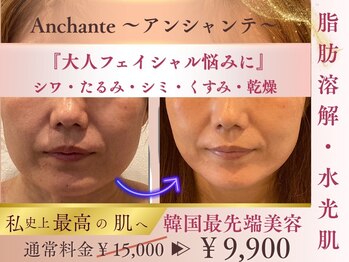 アンシャンテ(Anchant)の写真/韓国肌管理【憧れの透明肌＆小顔☆】理想のフェイスラインへ！輝く素肌をあなたに♪40代から変わる土台ケア