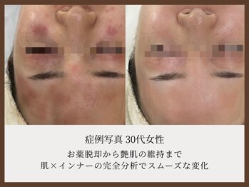シャルル ストア 京都三条通(Chaleureux Store)/
