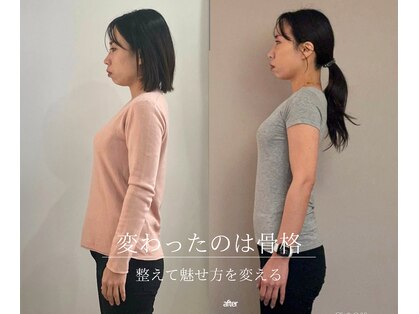 美容整骨サロン リペア(Repair)の写真