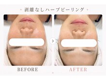 パールプラス 伊勢店(Pearl plus)/じっくり肌育☆トーンアップ◎