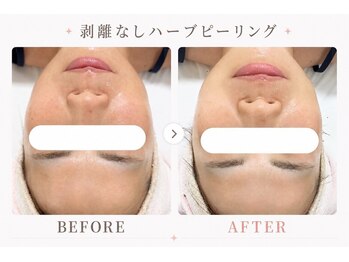 パールプラス 伊勢店(Pearl plus)/じっくり肌育☆トーンアップ◎