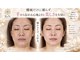 レン(ReN)の写真/【マイクロカレントセラピー】痛気持ちいいのに眠れる。筋肉から引き上げる本気フェイシャル