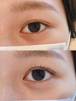 バードアイ(bird eye)/ラッシュリフト