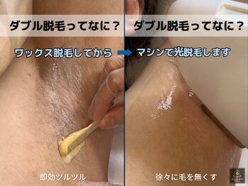 ロミオワックス 渋谷店(ROMEO Wax)/シェービング不要のダブル脱毛!!