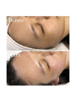 ホワイトワックス 京都四条烏丸(WHITE WAX)/ワックスでトーンアップ☆