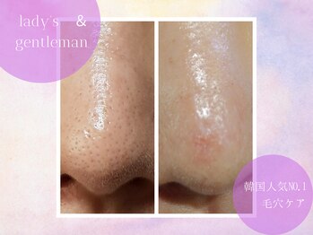 チャパン(Chapan)/韓国すっぴん美人＆毛穴ケア専門