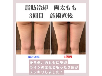 クリーンビューティーメディカルサロン(CLEAN BEAUTY Medical Salon)の写真