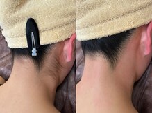 シェリー(Cherie)の雰囲気（うなじワックス＋光脱毛★アップスタイルも自信がつく！！）