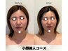【左右差】骨から歪みを全解消！美人黄金比で小顔に! ¥16,000→