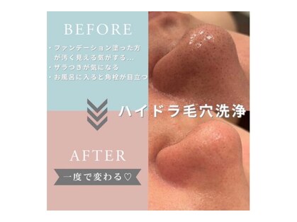 リリアン(lirien)の写真