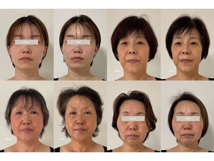 こつこつラボ サンイチマル オオル(310/OOL')の写真