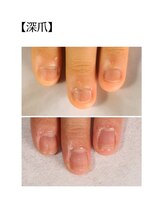 マーム(MA’AM)/〔深爪〕