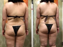 楽だの雰囲気（ハイパーナイフ＆シェイプ筋膜痩身★脂肪撃退荻窪で20年の手技）