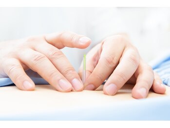 スクナビコナ鍼灸院/鍼を打つ様子