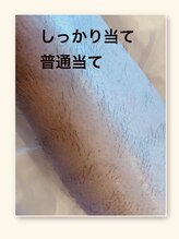 ママナ(mamana)/通常脱毛としっかり当て