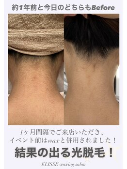 エリス(ELISSE)/お客様の理想の後ろ姿を叶えます