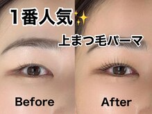 リアン(Lian)の雰囲気（頑固な下向きまつ毛が本当にあがる重たい一重がうっすら二重に）