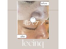 ルサンク(le cinq)