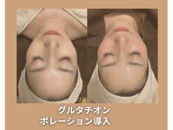 アオイスター(AOIstar)/発光美肌☆