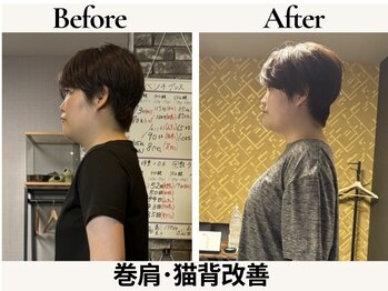 レガリス(REGALIS)/before/after 姿勢改善