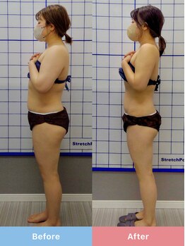 リスタート整体院 鹿児島(Restart整体院)/Restart痩身&ダイエット