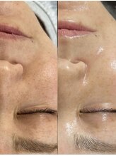 ロイヤル ビューティー サロン(Royal Beauty Saloon)/韓国発最新肌管理【セルマン】