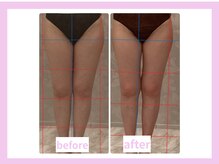 キワミビューティ(KIWAMI BEAUTY)/【WINBACK1回】足