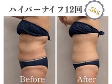 シーエーピーリュクス(C A P LUXE)の雰囲気（最新ハイパーナイフ7で全身本気痩せ！）
