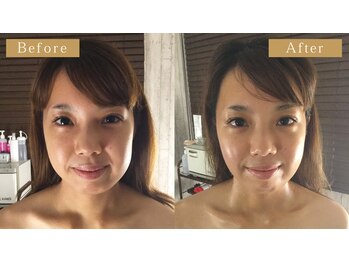 グレースフィオーレ 南越谷店(gracefiore)/南越谷の小顔矯正で肩こり改善