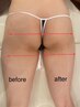 【ヒップUP・美脚形成】最新NR足の疲れも同時に解消に　￥17,000→￥8,000