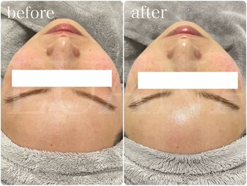 ルアナ(LUANA)/ララピール