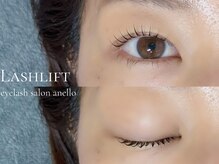 アネロ(anello)/ラッシュリフト