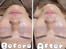 グラシア 倉敷店(Gracia)/お客様施術事例