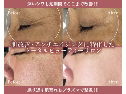 ビップフィール(vip feell)の写真