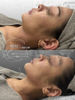 クレビア(CREBIA)/