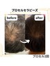 【男性】“自信を取り戻せ”本気の育毛促進”プロセルセラピーズ¥40000