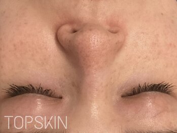トップスキン 名駅(TOPSKIN)/最新ハーブで本気のお悩み改善!