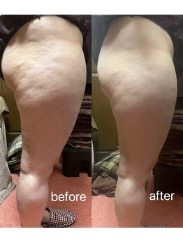 ヤン リン 整体(Yang Ling 整体)/セル脂肪撃退！