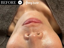 アングレイス(Anngrace)/【リリースカッター】/Bfore