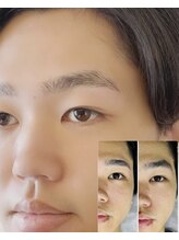 グロウビューティー(grow beauty)/