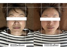 ダイアリー(DIARY)の雰囲気（人気の小顔矯正は通う程に効果UP!!イベントやデートの前にも☆）